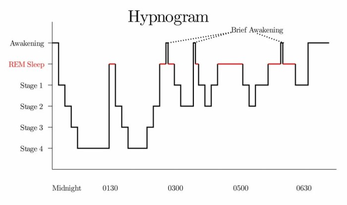 Sleep rem eye movement rapid during bodily body blood sleepopolis occur do approach fluctuations waking levels function pressure rate unique